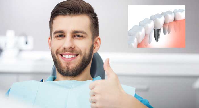dental-implants-browns-plains